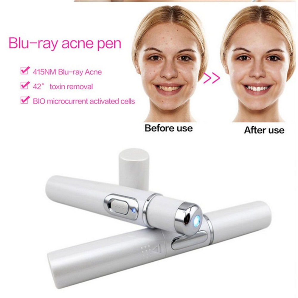 Photon Blue Light Acne Treatment Laser Pen for Radiant Skin Renewal