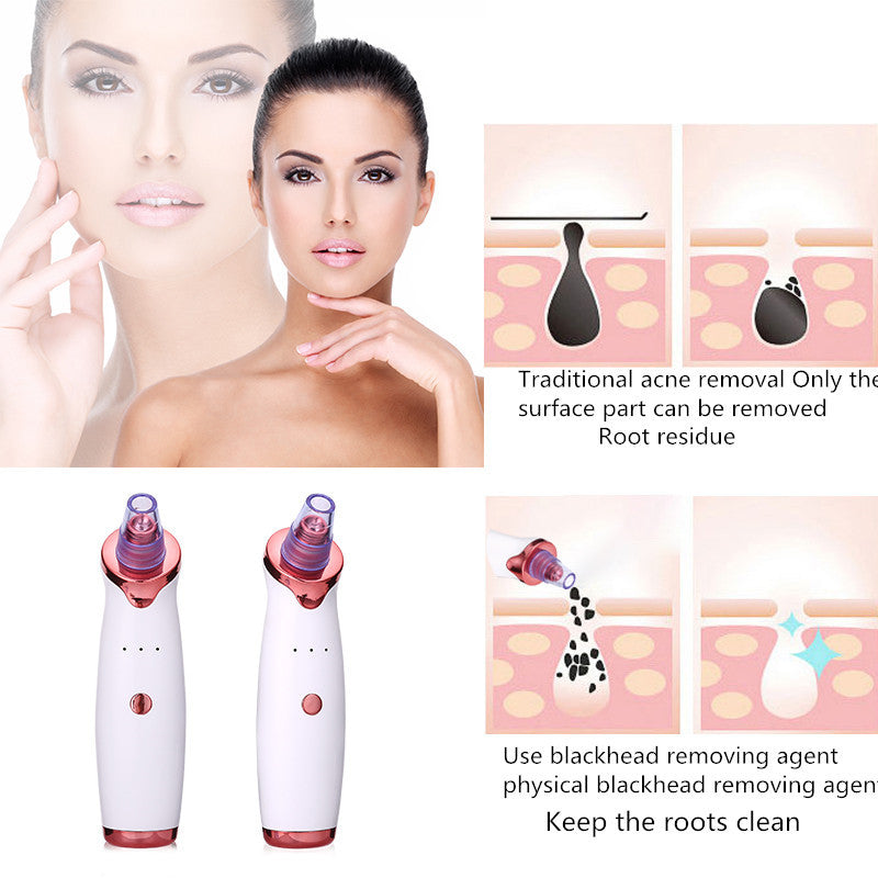 Blackhead Vacuum Suction Tool with Skin Rejuvenation Benefits