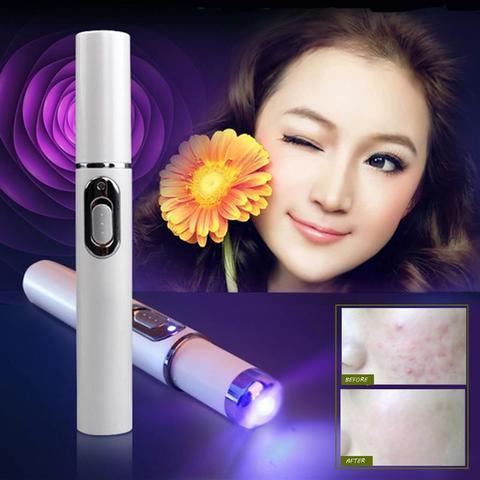 Photon Blue Light Acne Treatment Laser Pen for Radiant Skin Renewal