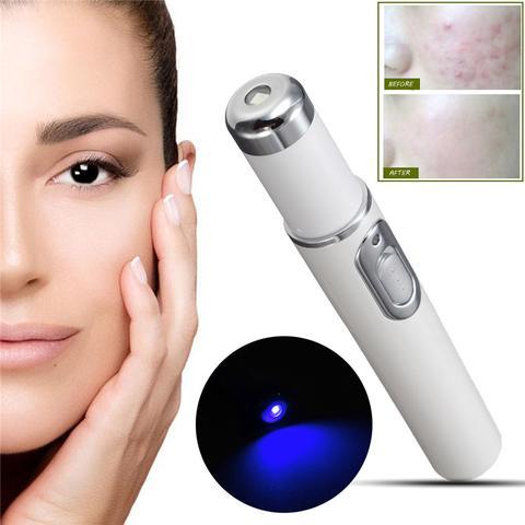 Photon Blue Light Acne Treatment Laser Pen for Radiant Skin Renewal