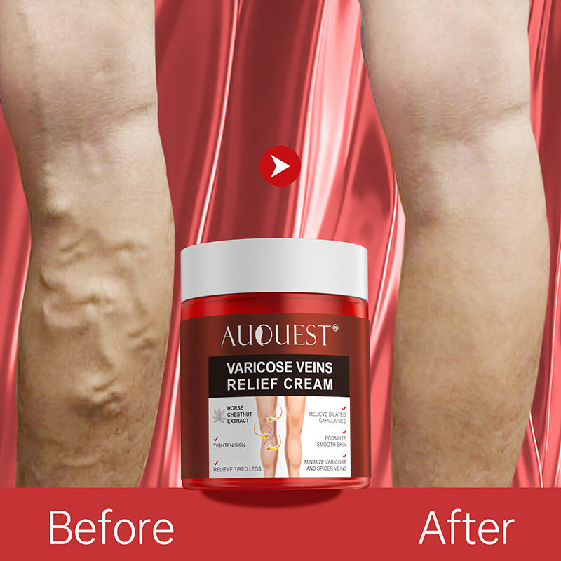 Vein Cream for Small Blood Vessel Bulging with Glue Effect