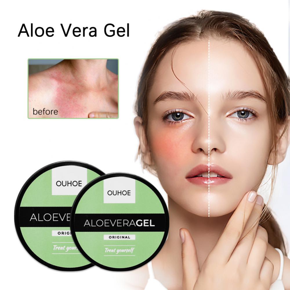 Sun-Kissed Skin Repair Gel with Aloe Vera